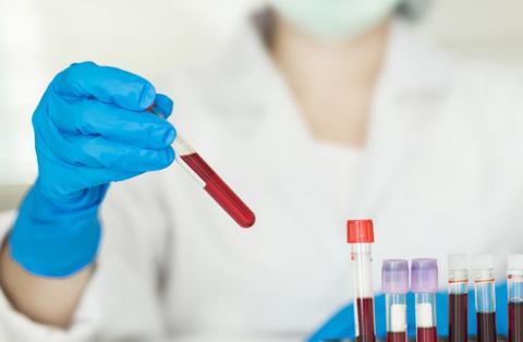 Laboratório de análises clínicas com funcionária coletando sangue